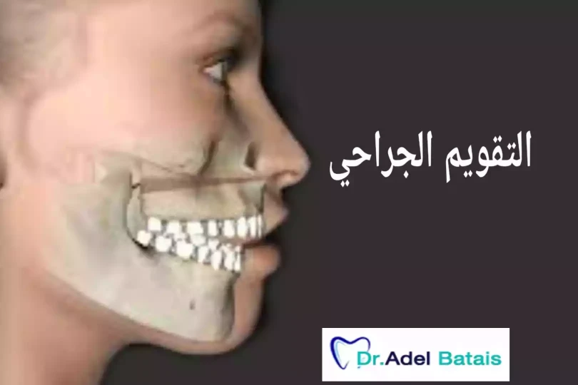 التقويم الجراحي